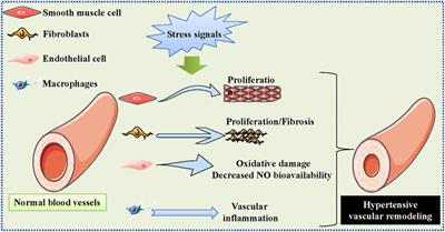 Benefits of Curcumin in the Vasculature: A Therapeutic Candidate for Vascular Remodeling in Arterial Hypertension and Pulmonary Arterial Hypertension?